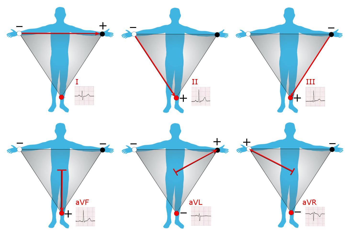 Placement position of ECG limbs and chest leads — Safdar et al.
