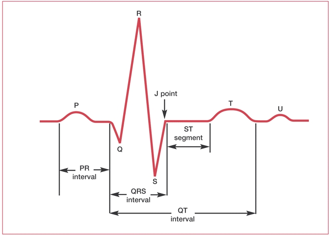 ECG tracing correlated to the cardiac cycle — USQ Pressbooks