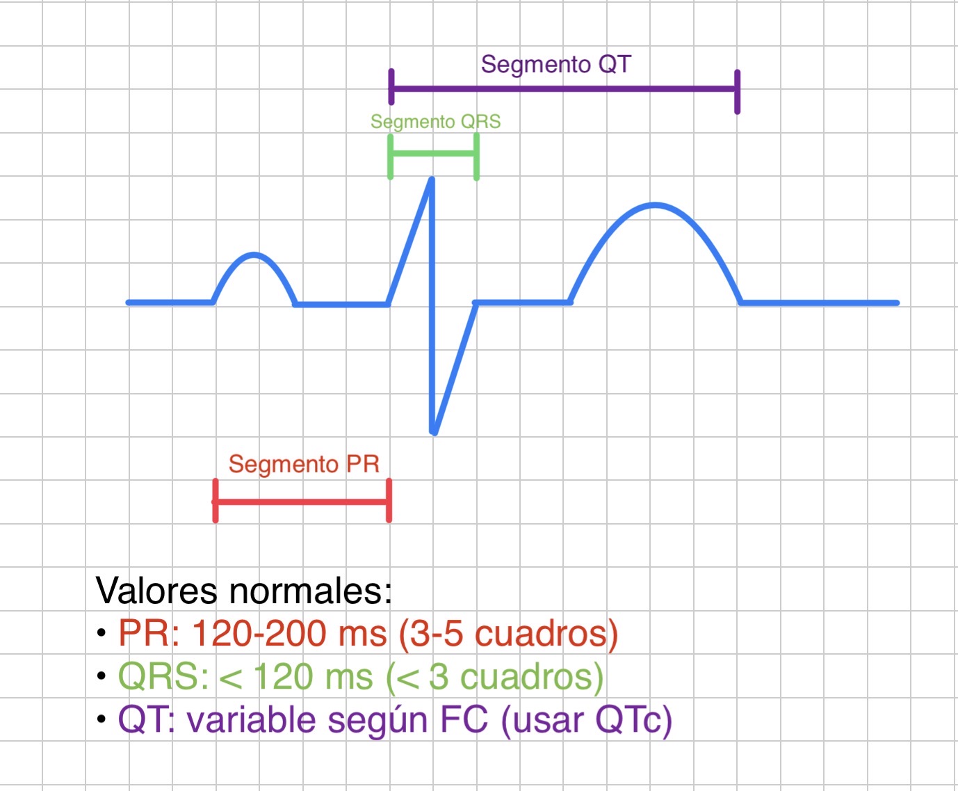 Ejemplo de medición de intervalos en papel ECG